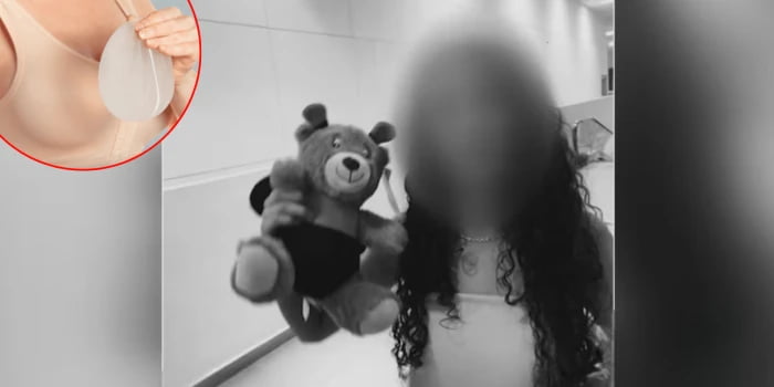 Niña de 14 años murió tras cirugía estética realizada por su padrastro